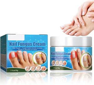 Nail Fungus Treatment Cream, 30g Strong Anti-Fungus Nail Treatment for Toenail Fungus, Fungal Nail Treatment For Athlete's Foot and Nail...