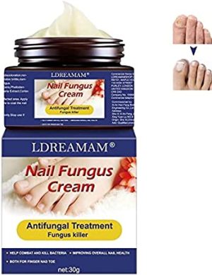 nail repair cream fungal nail treatment cream fungus nail care nail fungus