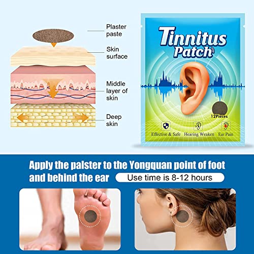 tinnitus relief for ringing ears 3