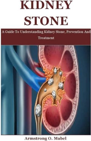 kidney stone a guide to understanding kidney stone prevention and treatment